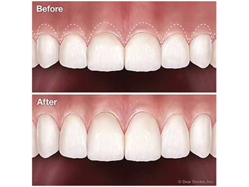 #คลินิกทันตกรรมเอพลัส #เฉพาะทางเด็ก #ทำฟันเด็ก #ทำฟันนครนายก #invisalign #จัดฟันใส #damon